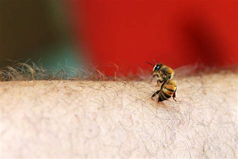 arı sokmasına karşı ne iyi gelir